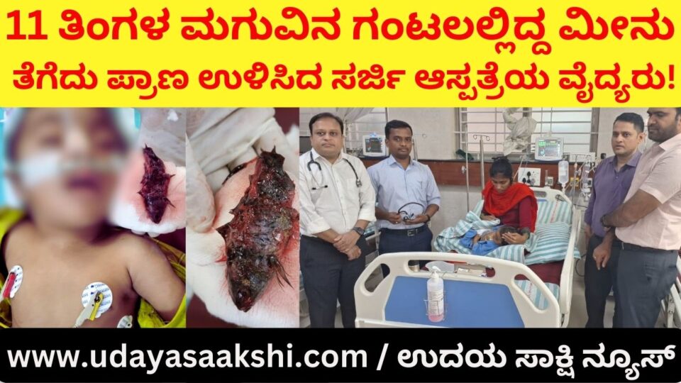 Doctors at Surgi Hospital saved the life of an 11-month-old child by removing a fish from his throat 11 ತಿಂಗಳ ಮಗುವಿನ ಗಂಟಲಲ್ಲಿದ್ದ ಮೀನು ತೆಗೆದು ಪ್ರಾಣ ಉಳಿಸಿದ ಸರ್ಜಿ ಆಸ್ಪತ್ರೆಯ ವೈದ್ಯರು
