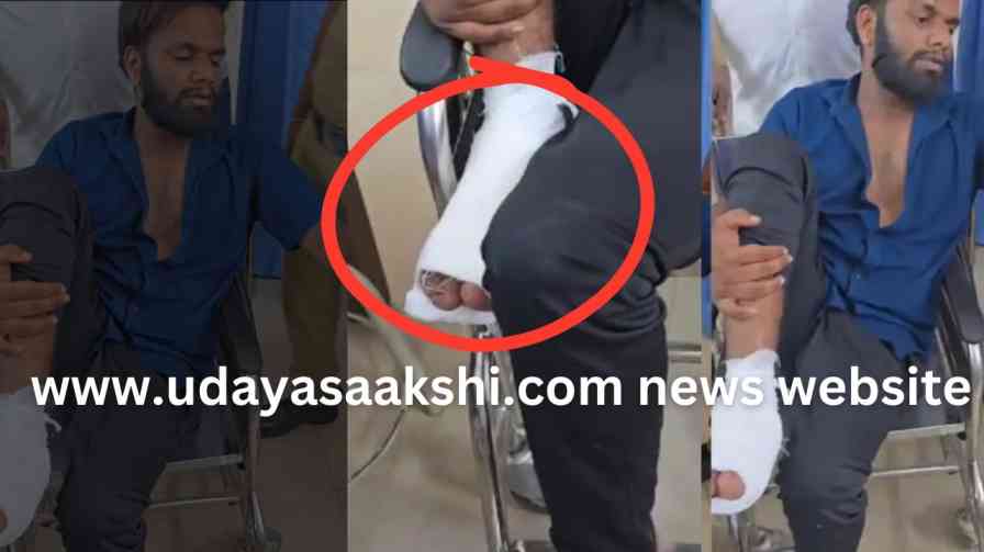 bhadravati | Bhadravati Police who are finally alerted: Rowdy sheeter shot in the leg! bhadravati | ಕೊನೆಗೂ ಅಲರ್ಟ್ ಆದ ಭದ್ರಾವತಿ ಪೊಲೀಸರು : ರೌಡಿ ಶೀಟರ್ ಗುಂಡನ ಕಾಲಿಗೆ ಗುಂಡೇಟು!